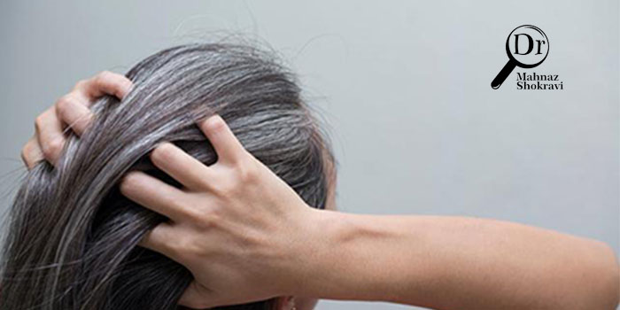 علت سفیدی زودرس موها چیست و آیا درمانی دارد؟