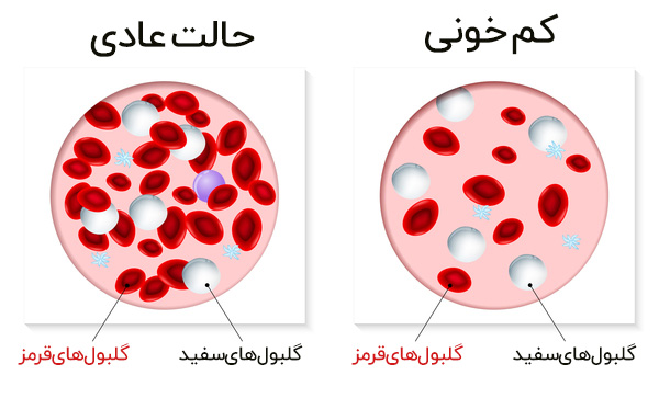 تالاسمی - دکتر مهناز شکروی