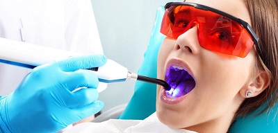 درمان آفت دهان-دکتر مهناز شکروی